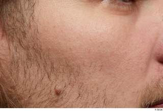 HD Arvid cheek face skin pores skin texture 0001.jpg